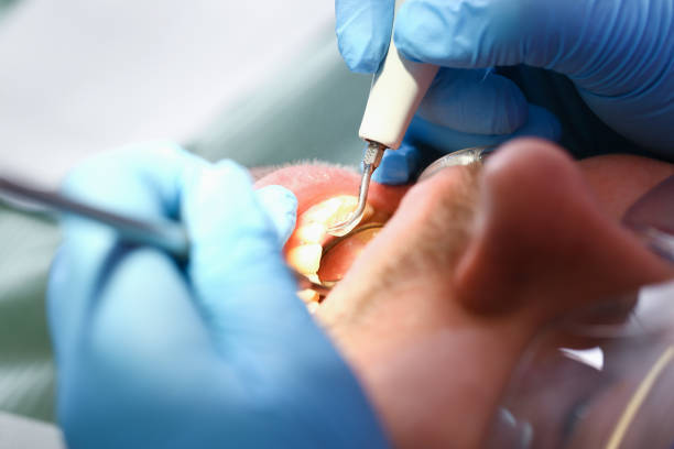 Best Emergency Dentist for Knocked-Out Tooth in Wrangell, AK