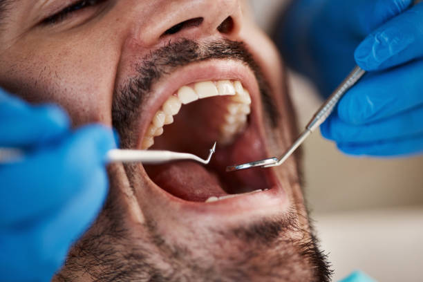 Best Emergency Dentist for Lost Fillings or Crowns in Wrangell, AK